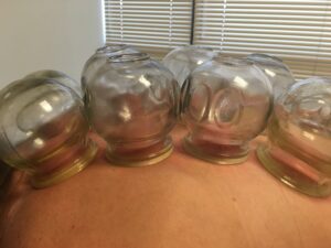 Cupping Services offered by Flow Rite with Edie