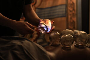 Cupping